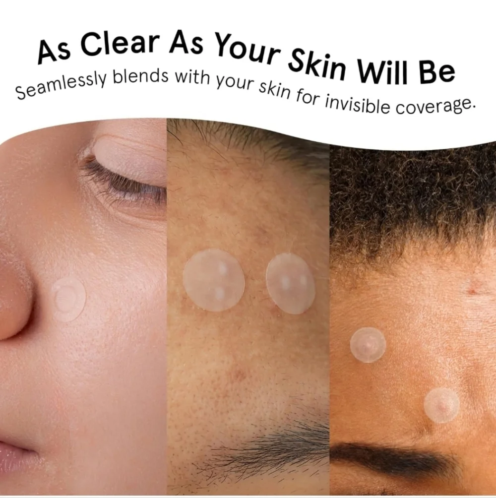 2 pck Pimple Patches for Face